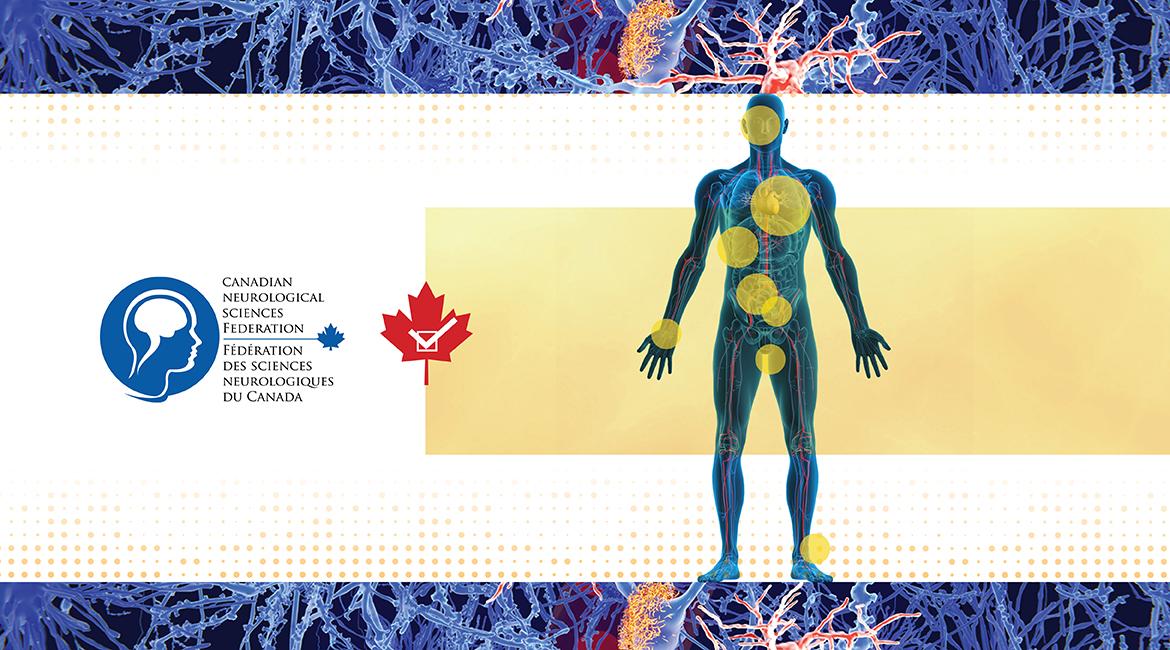 Bringing Canadian Guidelines to Life: Recommendations for Hereditary Transthyretin Amyloidosis Polyneuropathy (hATTR PN)
